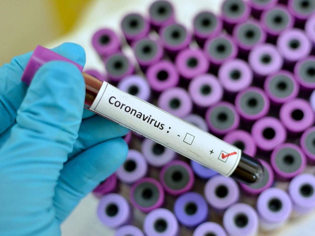 Family members of 4 infected persons put under quarantine in Valley